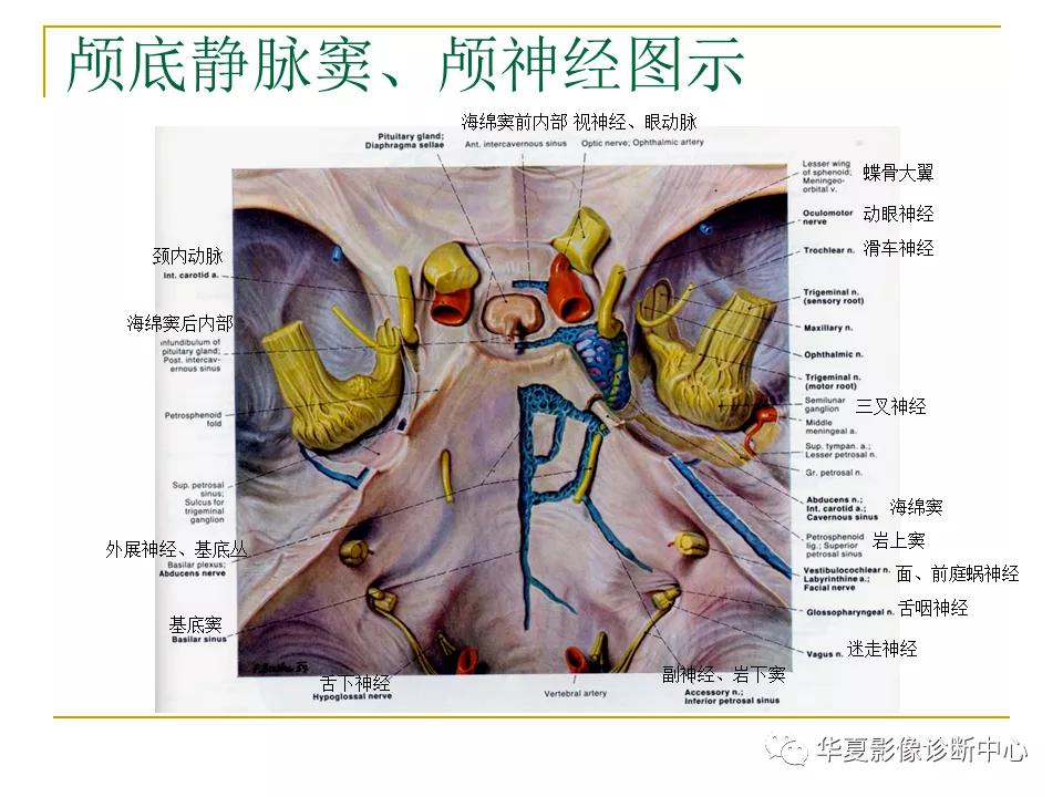 中国人脑立体定向mri应用解剖图谱,脑mri示意图