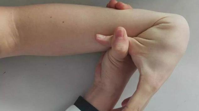 肩关节半脱位与肩关节脱位的区别,肩关节脱位最安全有效的方法