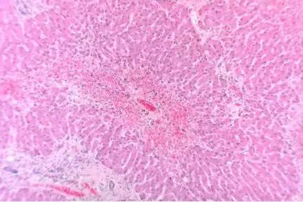 水蛭会不会吸走人身上的毒,水蛭是不是会吸血