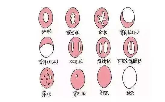13岁女孩月经期右下腹剧痛,11岁女孩小腹疼痛是不是来月经了