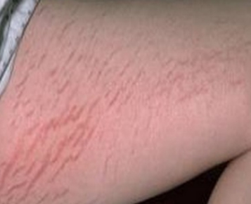 孕期身体乳保湿推荐,孕期保湿身体乳推荐