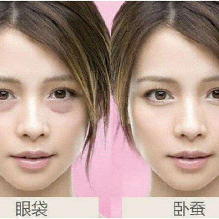眼袋越来越严重赶紧试试这个方法,大家是否知道眼袋形成的原因呢
