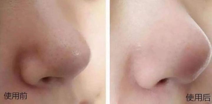 沐浴露洗面奶哪个清洁力更强,洗脸肥皂好还是洗面奶好