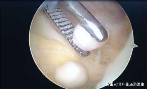 花椒泡水喝治什么病最有效,辟谣花椒功效