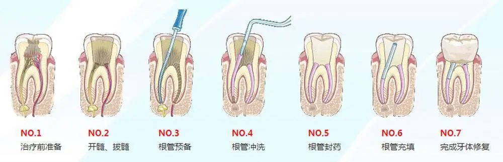 牙齿松动是什么原因怎么治疗,牙疼时牙齿会松动不疼时不松动
