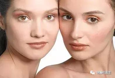 果酸换肤效果特别明显,果酸换肤亲身经历效果好不好