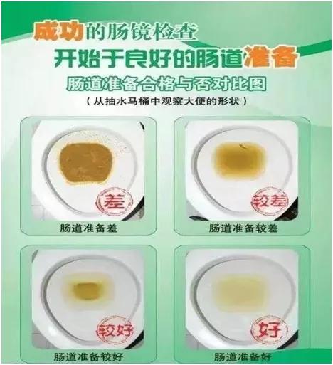 全麻胃肠镜检查后的注意事项,胃肠镜检查后吃饭注意事项