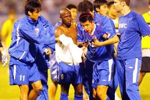 韦世豪恶意伤人事件,韦世豪足球事件