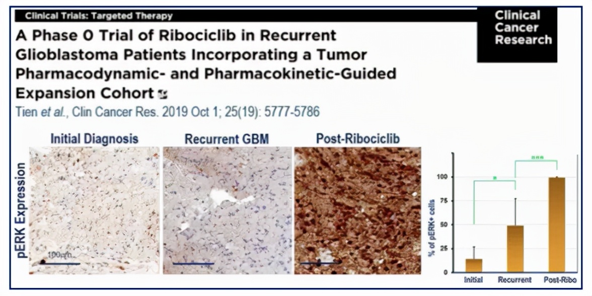 免疫治疗胶质瘤最新进展,胶质瘤能用靶向药物治疗吗