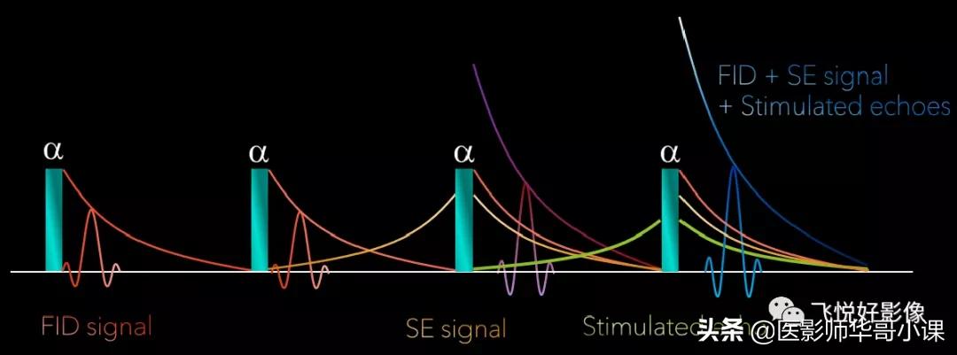 飞利浦磁共振波谱扫描方案,飞利浦1.5t磁共振mri操作使用手册