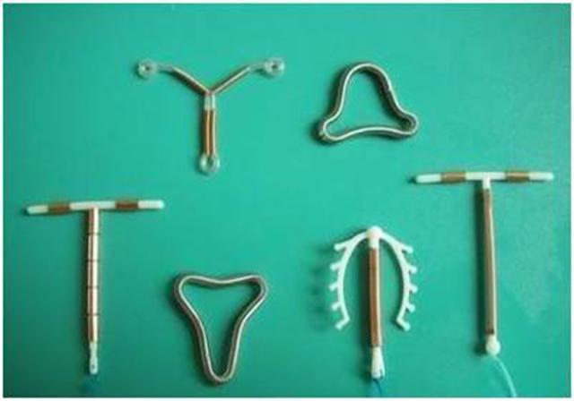 已上环10年取出来会很痛吗,10年前节育环下移