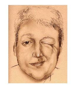 到底是左眼跳财还是右眼跳灾,到底是右眼跳灾还是左眼跳灾