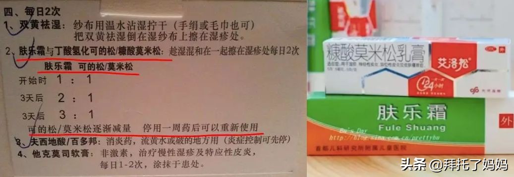 湿疹膏十大排行榜网红药膏,外包装花里胡哨的湿疹药膏