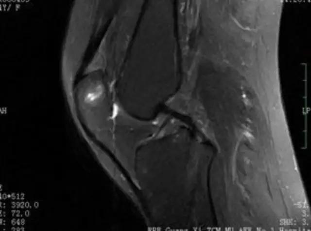 mri临床医师必读电子书,临床医生如何读mri