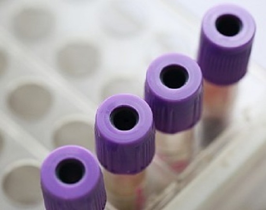 rfid在物流行业的应用,rfid智能采血管理系统