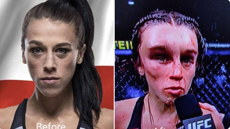 一龙恭喜张伟丽战胜乔安娜,最新消息一龙对张伟丽的看法