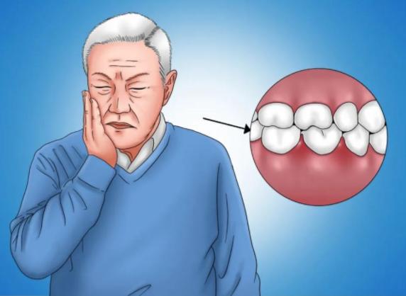 70岁老人种牙好还是义齿好,义齿和种植牙的区别老年人