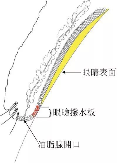 干眼症可以彻底治愈吗,干眼症能彻底治好吗