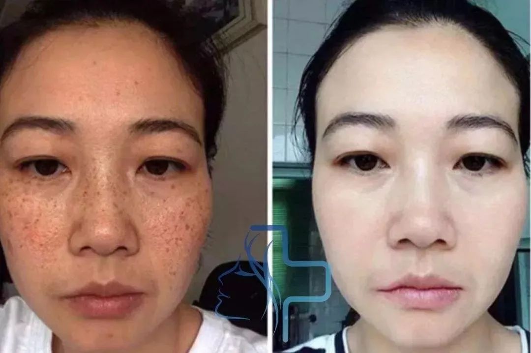 经常这样喝让你的脸色红润还养颜,每天坚持这样喝皮肤又白又嫩