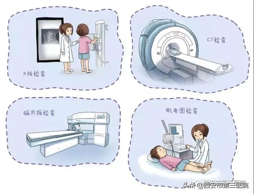 如何判断何种类型的颈椎病,最简单的颈椎病自测方法