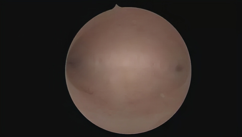 女性做amh检查要注意什么,女性检查必做项目以及时间