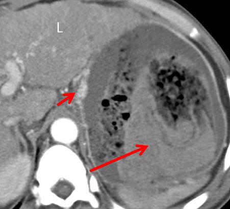 腹部ct能看出来胃的毛病吗,如果胃有问题腹部ct看得出来吗