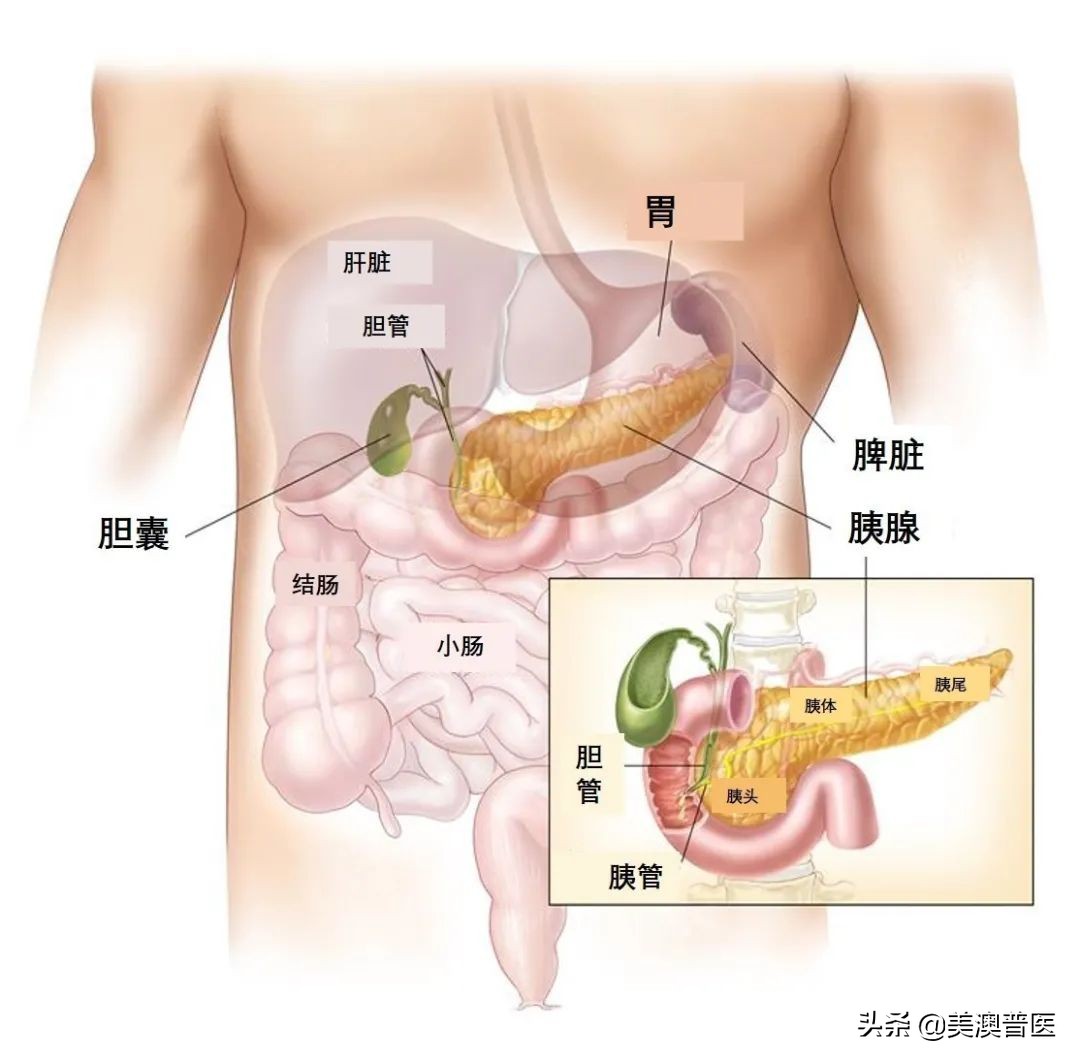 吃海鲜容易得胰腺炎,胰腺炎是胡吃海喝导致的吗
