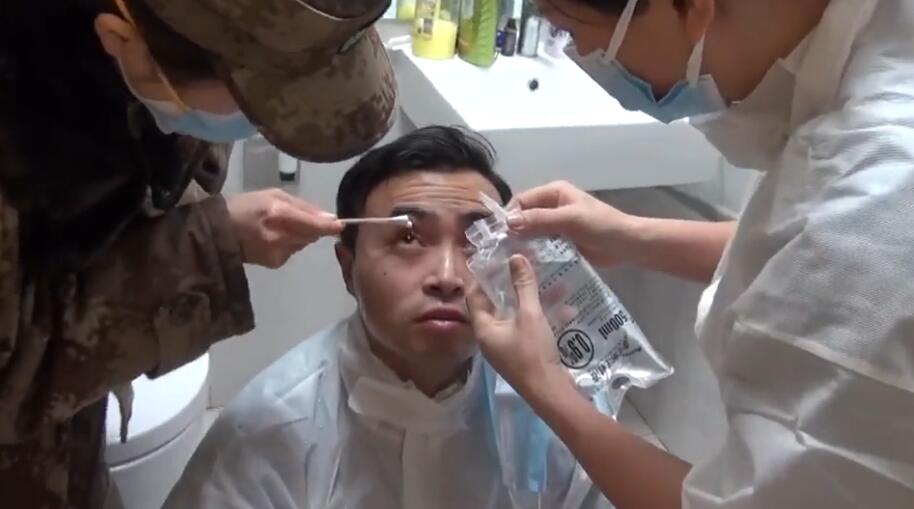 眼睛滴了502把眼皮烧烂了多久能好,眼皮被502胶水粘住教你一招解除