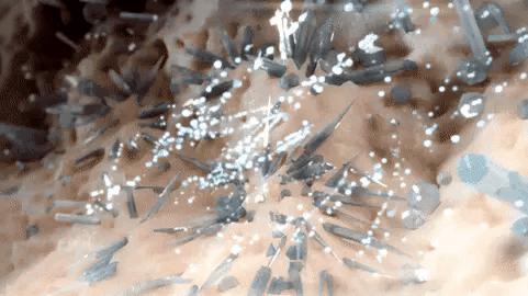 吃海鲜喝啤酒痛风了怎么缓解痛风,喝啤酒引起急性痛风关节炎