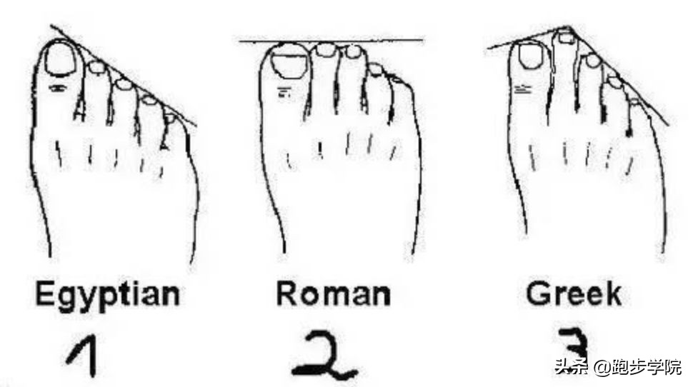 跑步跑出黑指甲代表什么,跑步黑指甲还能再跑吗