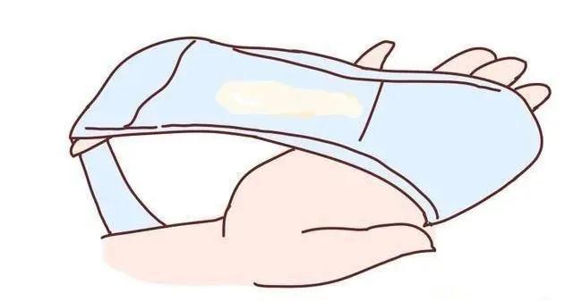 鐪熻弻鎬ч槾閬撶値鐨勭棁鐘朵笌娌荤枟,鐪熻弻鎬ч槾閬撶値鐨勭棁鐘跺拰娌荤枟