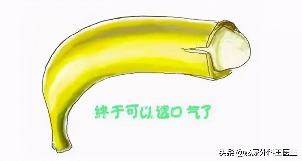 男性阴茎癌病前征兆,阴茎癌青年发病率