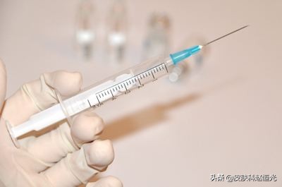 斑秃多久会好如何有效治疗斑秃,斑秃症状揭秘如何识别并治疗斑秃