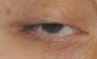 协和整形医生谈整容,你到底该不该整容