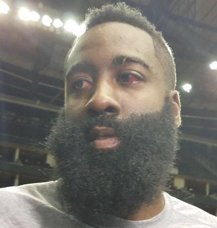 格林戳眼哈登给恶意了吗,戳眼哈登塔克采访