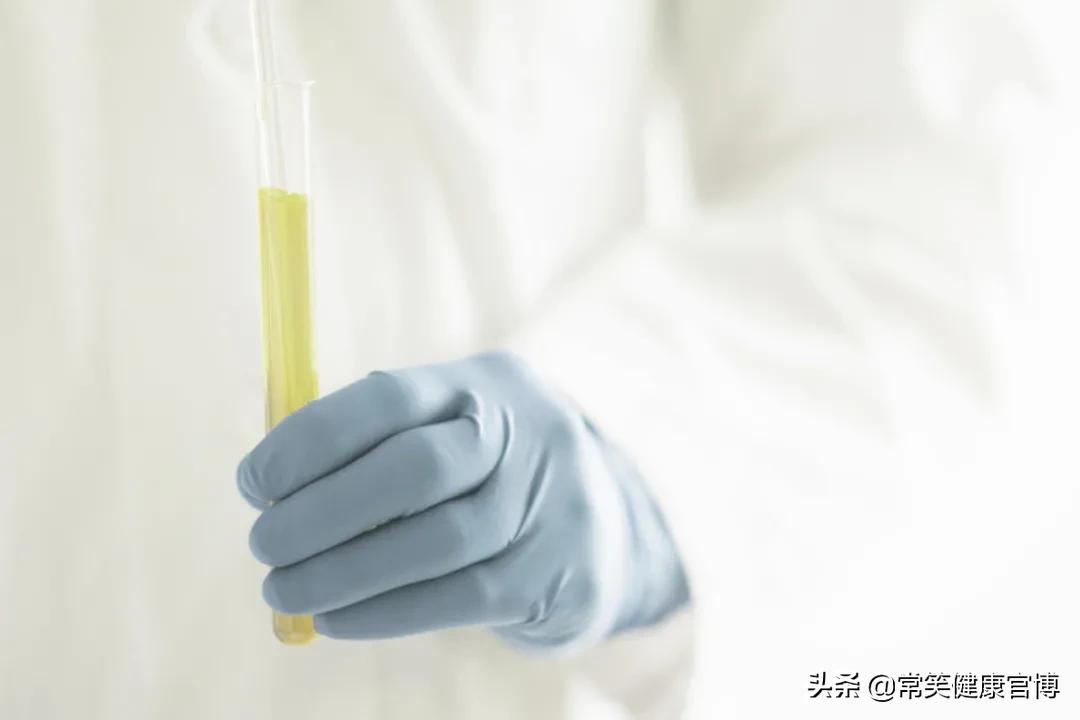 尿液淡黄色和深黄色的对比,尿液黄色和淡黄色的区别