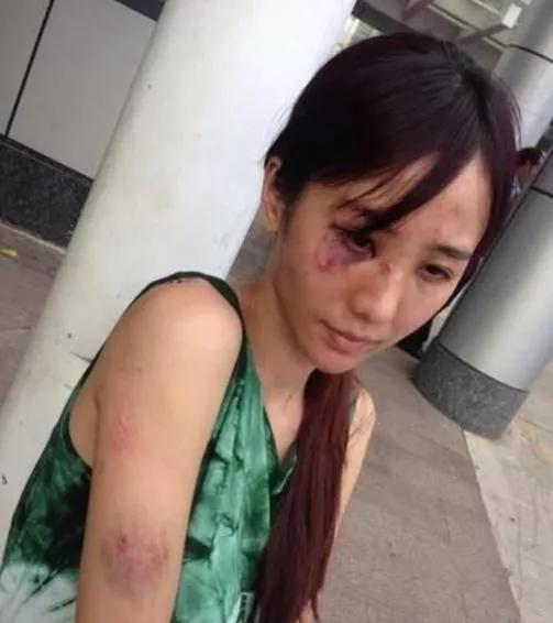 女记者被家暴成“另一个拉姆”，值得同情吗？要远离这几种男人