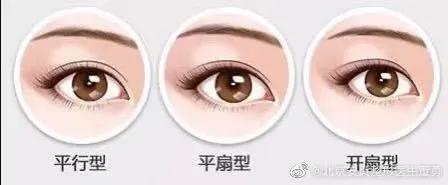 内双适合割什么样的双眼皮,怎样选择适合自己的双眼皮