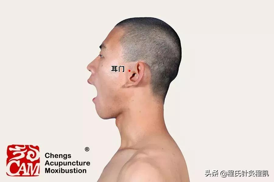 中医治疗耳鸣的效果怎么样,感冒耳鸣怎么快速消除按哪个穴位