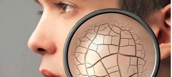 毛孔粗大原因及如何改善,毛孔粗大爱出油是什么原因