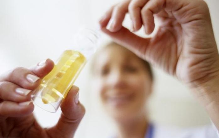 尿痛有哪些疾病,女性尿痛要警惕三种病