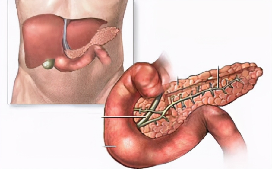 50岁的阿姨抽出“猪油血”，医生提醒：春节饮食要注意
