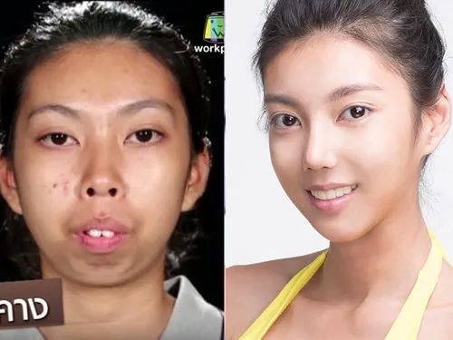 泰国最逆天的不是变性，而是堪比换头的整形