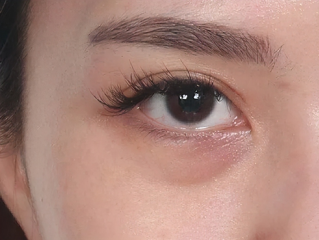 如何分清眼袋和卧蚕的区别图解,卧蚕和眼袋哪个显老