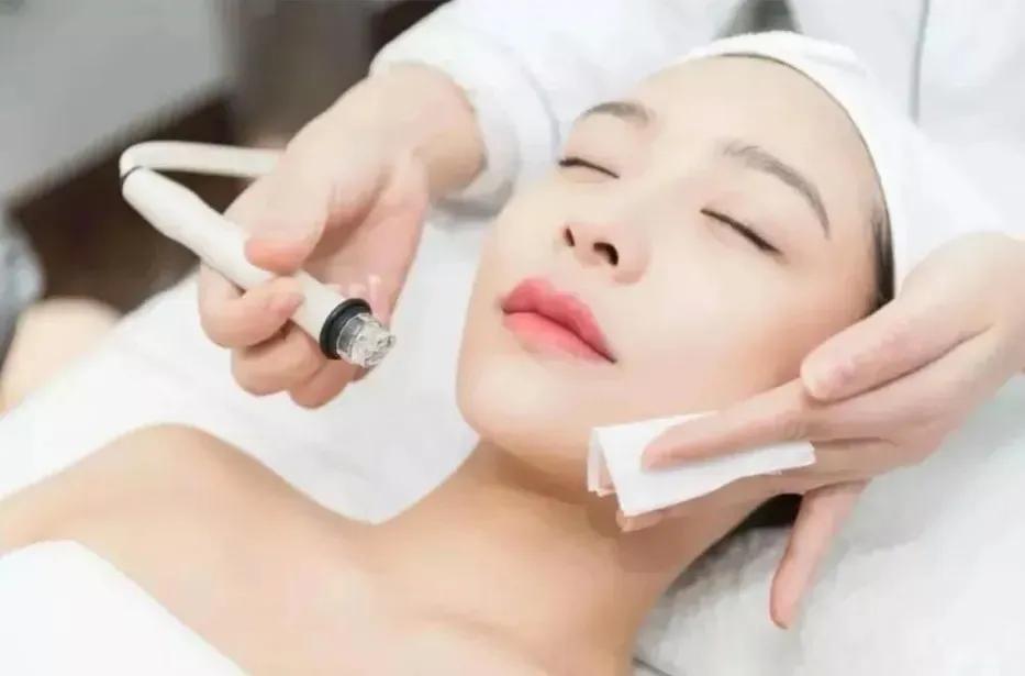 黑头用黑头贴去不掉怎么办,白糖去黑头的正确方法