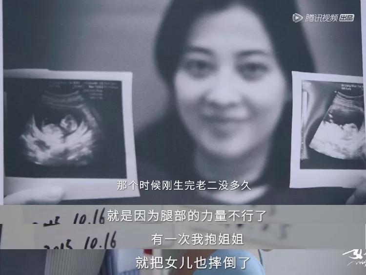 ella揭秘生育后遗症,ella曝光产子影片