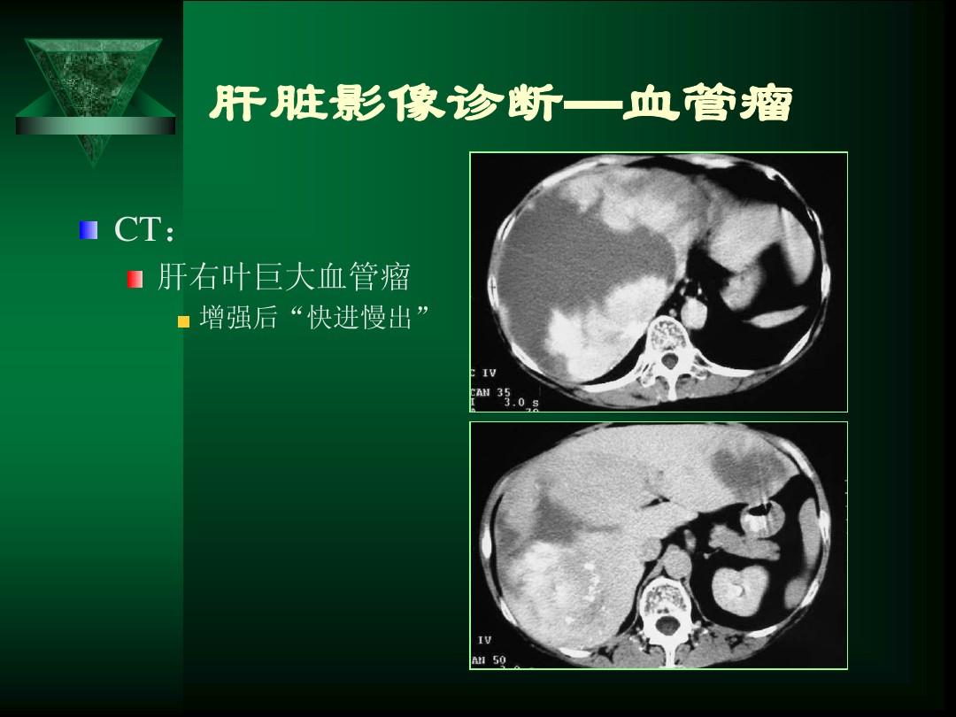 肝脏长东西就是癌症吗,肝脏长东西怕不怕