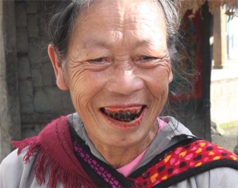 海南人吃生槟榔为什么不得口腔癌,海南嚼槟榔为什么不会得口腔癌