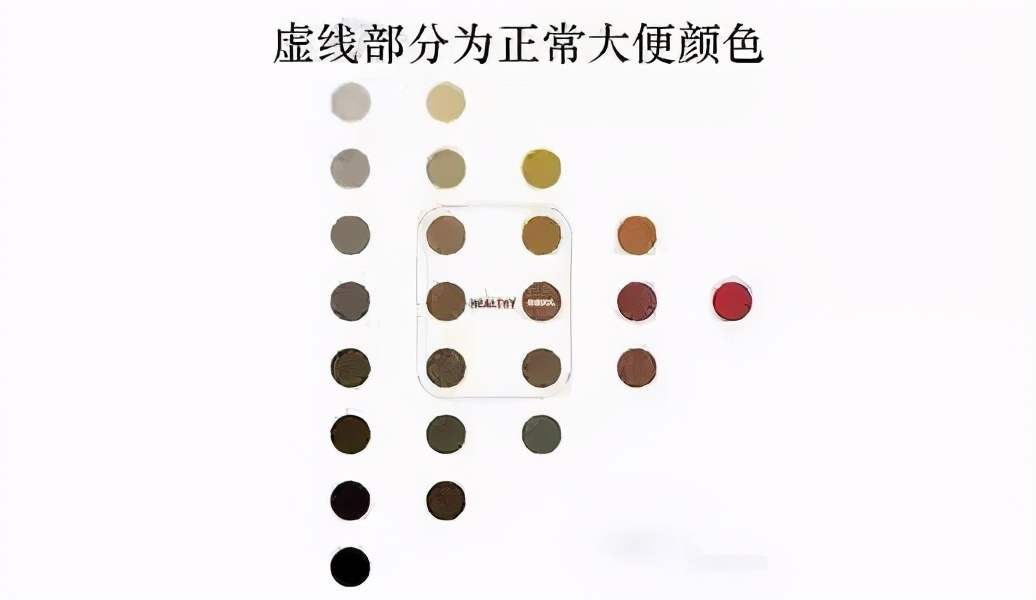 大便之后咋处理,大便完后注意什么