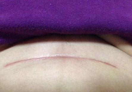 坐月子牢记这几点出月子脱胎换骨,坐月子调理月子病的真实案例